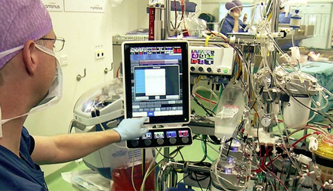 St. Antonius Ziekenhuis werkt met innovatieve hartlongmachine