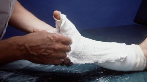 Een arbeidsongeschiktheidsverzekering brengt talloze voordelen met zich mee